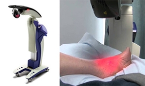Benefits of MLS Laser Therapy