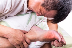 Recognizing Signs of Gout in the Feet